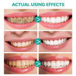 Whitening-Schaum-Zahnpasta